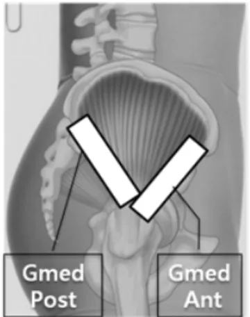 Fig. 1. Position of ultrasonography probe통증과 가장 심할 때 통증의 정도를 파악하기 위해 전세