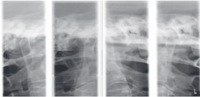 Fig. 2. Initial panoramic radiographic image before 