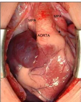 Fig. 3. Angiogram shows both great vessels arising 200% 