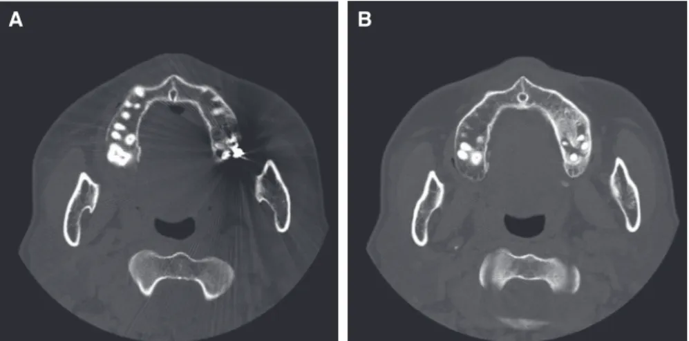 Fig. 6. Periapical standard radiograph was taken  at different angles to confirm two separated.