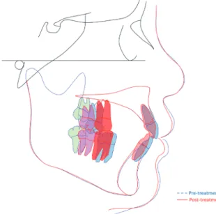 Fig. 4. Post-treatment panoramic and lateral cephalometric radiographs of Case I.