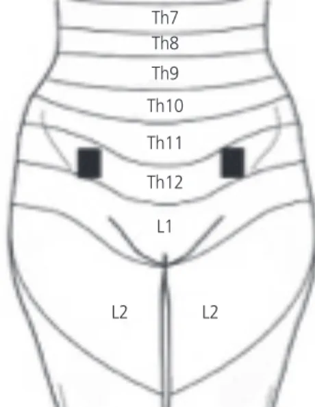 Fig. 2. Electrode placement L1 (front) and Th12 (back).