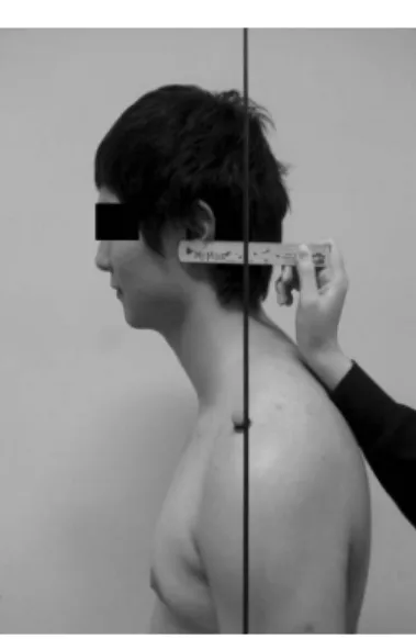 Fig. 1. Measure of subjects with forward head posture 2. 실험도구
