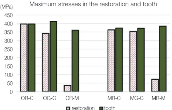 Fig. 4. Minimal invasive cavity designs (OR-M, MR-M) produced very small maximum von Mises stress magnitude  compared to conventional inlay designs in the restoration