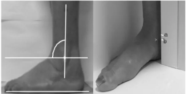 Fig 2. Measurement for foot posture