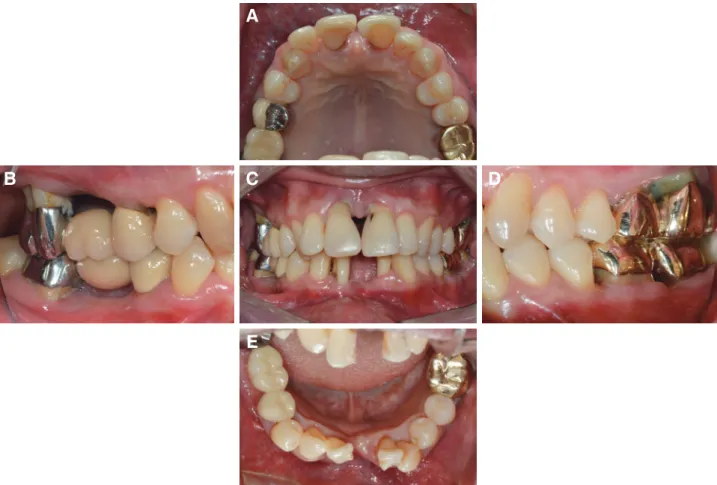 Fig. 2. Radiographic evaluation before treatment (Panoramic  view).