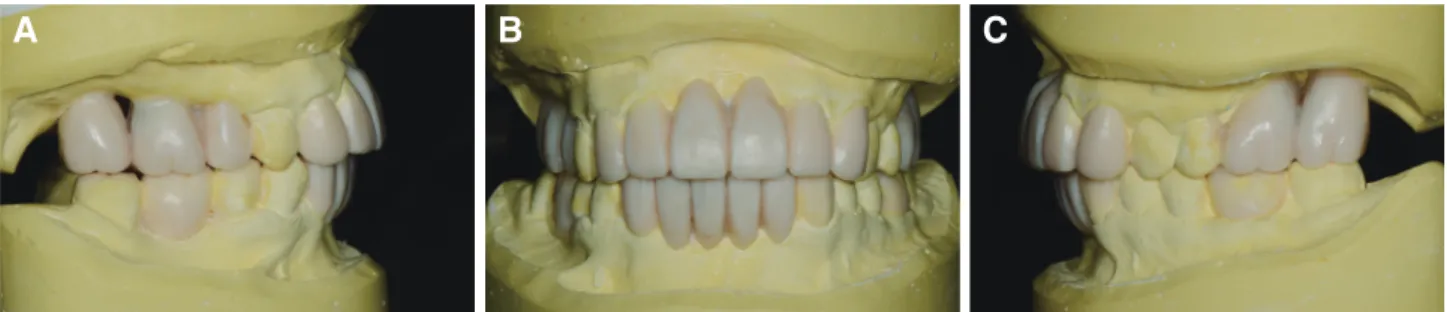 Fig. 4. Panoramic radiograph after implant installation.