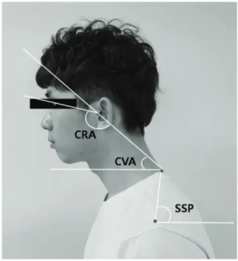 Fig. 1. Measuring the CRA, CVA, SSP CRA: Cranial rotation angle, CVA: Craniovertebral 