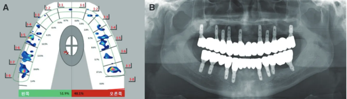 Fig. 20. Extraoral photograph after treatment. The treatment was remarkable both esthetically and functionally.