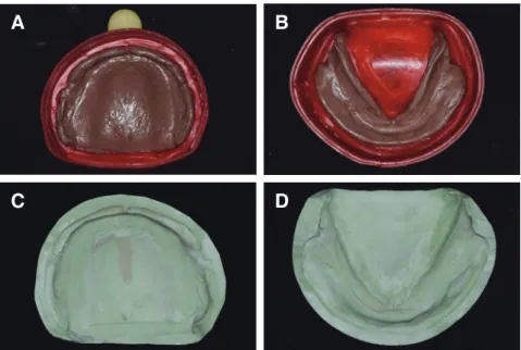 Fig. 5. Vertical dimension and centric recording (A), Mounting of master casts (B).