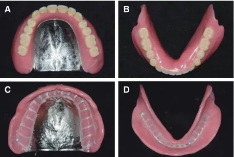 Fig. 10. Polished surface (A, B), tissue surface (C, D) of new denture.