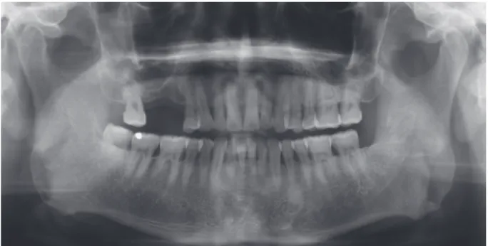Fig. 2. Initial clinical photograph; upper view.