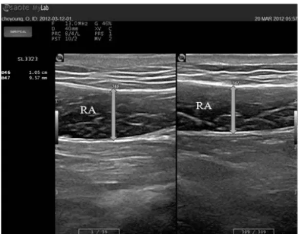 Fig 3. Bridging Exercise with Adductor Contraction     