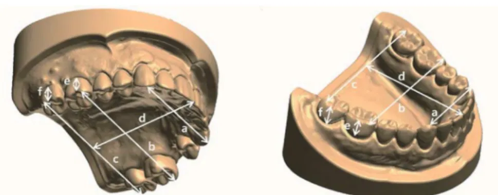 Fig. 2. Linear measurements made on each digital model. (A) Incisor to molar, (B) Intermolar width, (C) Incisor height.