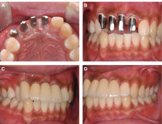Fig. 7. Post treatment radiographic image. (A) Panoramic radiographic image, (B) Periapical standard image.