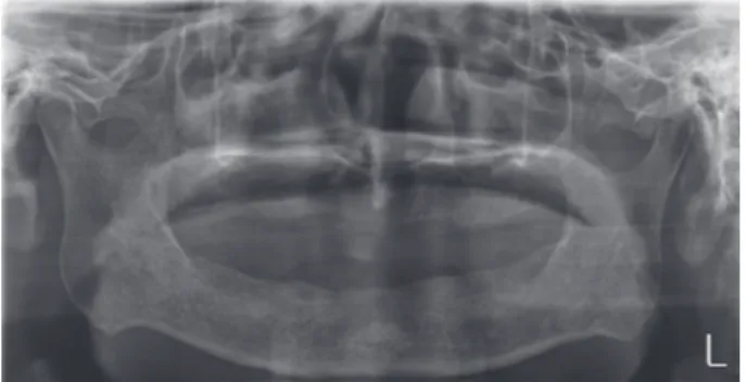 Fig. 2. Initial intraoral photographs. (A) Maxillary view, (B) 