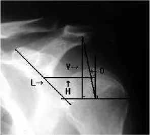 Fig 1. Quantitative radiographic measurements