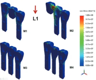 Fig. 4. Maximum von Mises stresses generated in the  implant fixture, screw, and abutment by L2 load