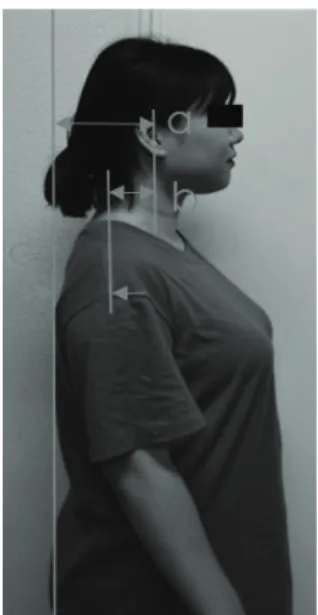 Fig. 1. Description of postural angles measurement  from the photographs