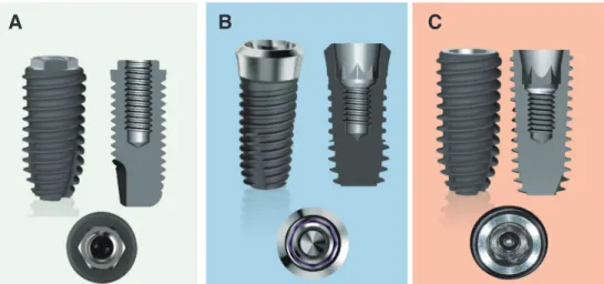 Fig. 1. Three types of implant-abutment connection. (A) External butt joint connection (EXT), (B) Slip fit internal butt  connection, tissue level (TL), (C) Internal conical connection (ICC)