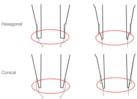 Fig. 8. Single engagement feature (left) and double engagement feature (right). 