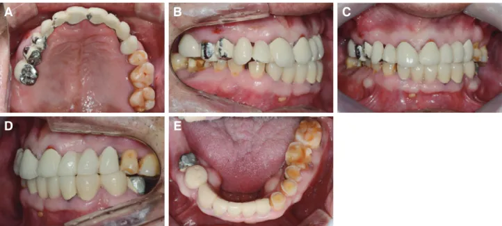 Fig. 2. Panoramic radiograph before treatment.