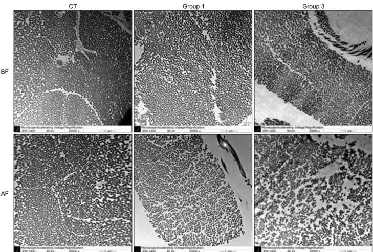 Fig. 4. Electron microscopy findings (×20,000), CT (control group, only after fixation)