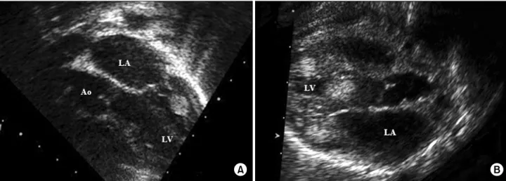 Fig. 3. Follow-up echocardiogram at three year after operation. (A) Apical four chamber view showed complete release of left ventricular  outflow tract obstruction