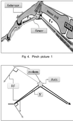 Fig 3. Pulp pinch position