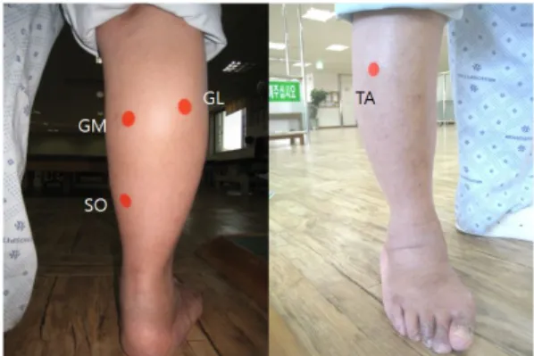 Figure  7.  Locations  of  sEMG  electrodes  attachment.