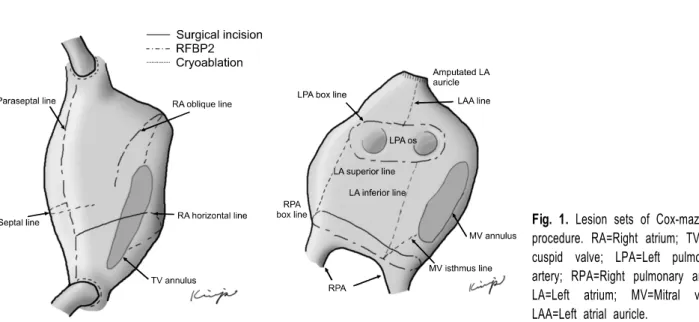 Fig. 1. Lesion sets of Cox-maze IV  procedure. RA=Right atrium;  TV=Tri-cuspid valve; LPA=Left pulmonary  artery; RPA=Right pulmonary artery; 