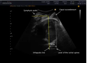 Fig. 3. Relationships among the angle of progression, cervical length, and gestational age
