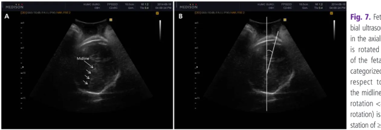 Table 1. Intrapartum ultrasonographic techniques according to various situations of women in labor