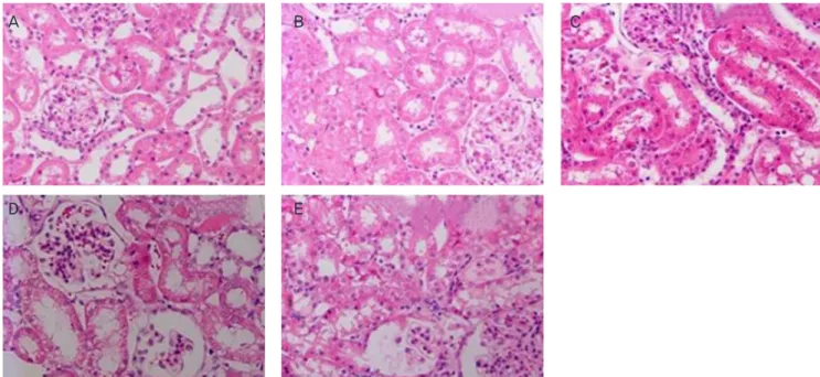 Fig. 3. Histopathological analysis in renal cortex in the groups of rats studied: (A) control, (B) green tea extract (GTP), (C) CP+GTP pre-treatment  (CP+preGTP), (D) cisplatin (CP), and (E) CP+GTP post-treatment (CP+postGTP)
