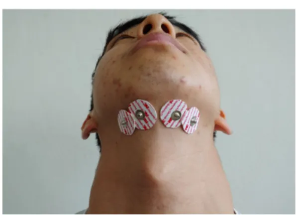 Fig. 3. Position of electrodes