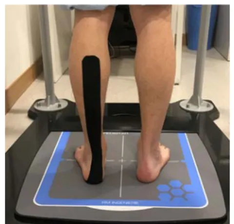 Fig. 2. Calf muscle tape placement