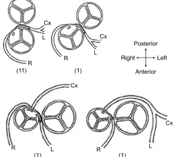 Fig. 1. Great artery relation and coronary artery patterns. ( )= 