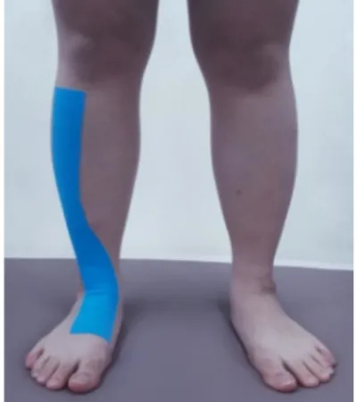 Fig. 1. Y Balance test