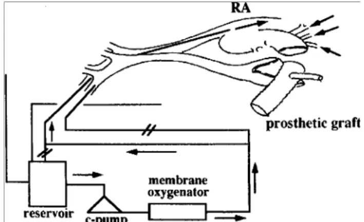 Fig.  2.  Saggital  views  of  CT  scans.  Preoperative  CT  scan  showed  a  dissected  collapsed  true  lumen  at  the  thoracic  descending  aorta  (A)  and  postoperative  CT  scan  showed  a  corrected  true  lumen  with  replacement  of  a  vascular 