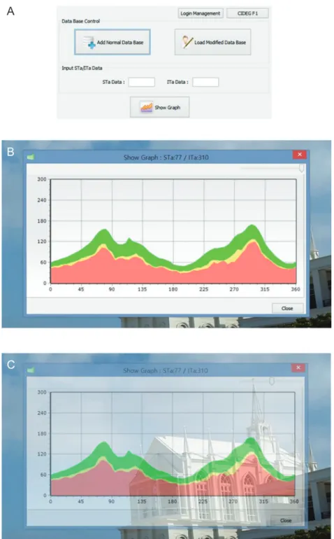 Fig. 1. A demonstration of an overlaying function using our custom-built software. (A) The main window of the custom-built software  shows the principal features including database management, artery information input window, and the graph visualization fu