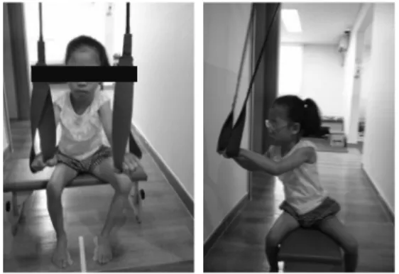 Fig 1. forward reaching  Fig 2. side reaching 두 손으로 고리 끼우기,  양팔을 옆으로 뻗기,  양 팔을  몸 옆으로 뻗어 목표물 닿기의 중재를 진행하였고 대조 군은 이러한 현수보조장치가 없는 환경에서 시행하였 다 