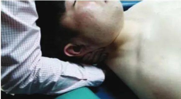Fig. 1. Joint mobilization on T2~T4 Fig. 2. Joint mobilization T1~T23개월 이상의 목부위 통증이 있는 20대 성인 남자로 연구대상자 선정기준은 목 부위의 신경학적 징후가 없고,  목 부위에 지속적 혹은 간헐적인 통증을 호수하고, CVA이 52도 이하인 자로서 보존적치료(그룹 Ⅰ),  보존적치료와 신장운동(그룹 Ⅱ),  보존적치료와 위등뼈 관절가동술(그룹 Ⅲ)으로 나누어 그룹 당 10명을 무작위 선정하였
