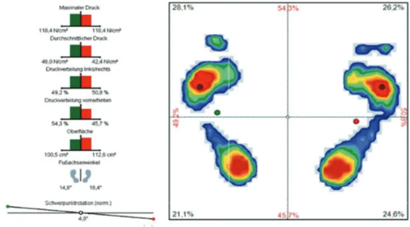 Fig. 1. Pedoscan