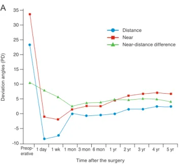 Fig. 1. Distance deviation, near deviation, and near-distance dif- dif-ference over time