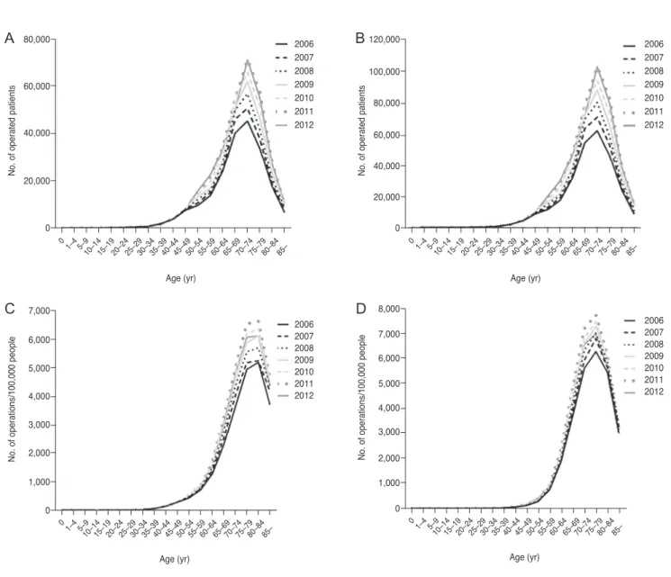 Fig. 1. Peak age group with regard to number of patients, number of operations, number of patients per 100,000 people, and number of  operations per 100,000 people according to age group and sex