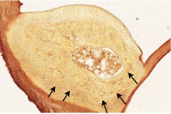 Fig  1.  Expression  of  IL-6 