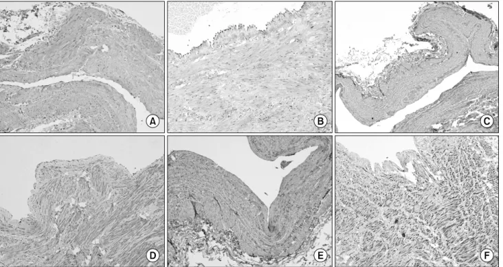 Fig. 1. Photomicrographs show immunohistochemical findings of MMP2 (A: ＋, B: ＋＋＋), MMP13 (C: ＋, D: ＋＋＋), and TIMP4 (E: ＋,  F: ＋＋＋) in the vascular wall (×40)
