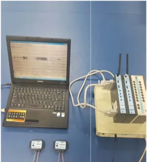 Fig. 1. Surface electromyography.