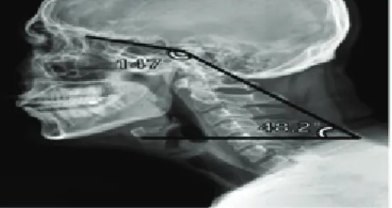 Fig. 3. Self-stretching exercise and passive stretching exercise.