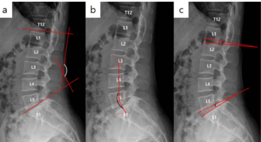 Fig. 1. Lateral radiographic images (a: lumbar lordosis, b: lumbosacral lordosis, c: lumbosacral intervertebral joint angle)
